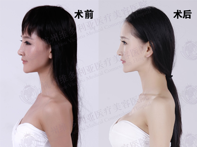 ¡��ǰ��(du��)�ȈD