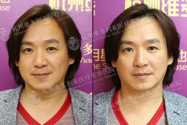 ���ݾS���������Ż��С��䳲Ƥ��