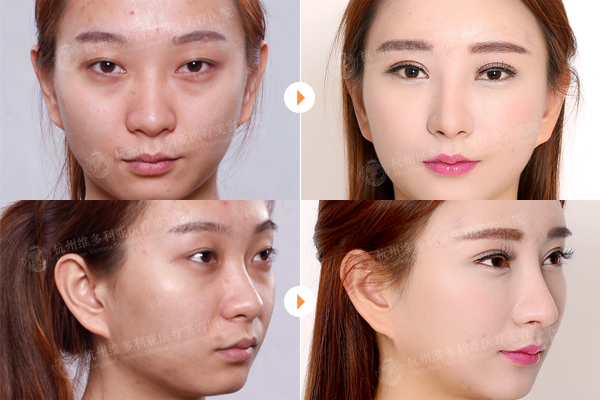 ���ݾS��������ͦ¡��